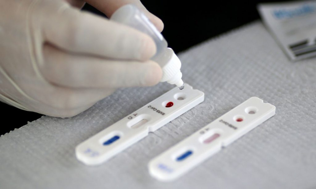 2020-04-28t173535z_1_lynxnpeg3r1y7_rtroptp_4_health-coronavirus-brazil-1024x613