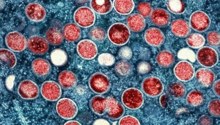 01DCF58A-1566-4041-9516-6BF0BFA8FAB5