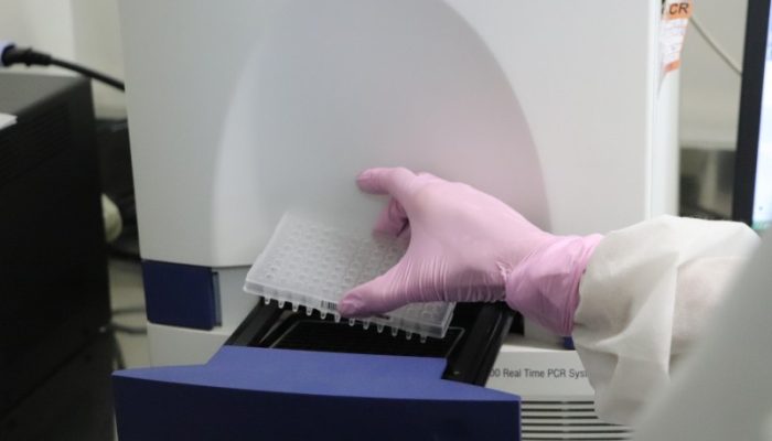Exame de biologia molecular identifica o vírus pela carga genética. - Foto: Divulgação/SES