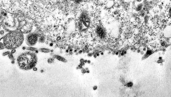 O estado tem onze casos suspeitos que serão analisados pela Fiocruz (Foto: Débora Barreto/Fiocruz)