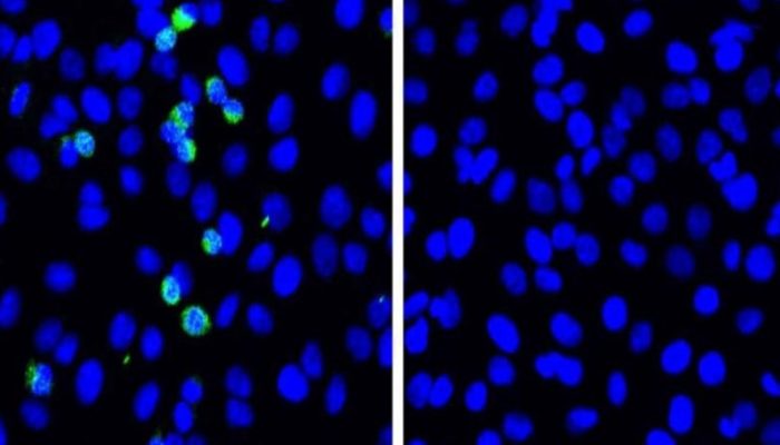 424d84a0676dd5a668dfb39dc5395fb8