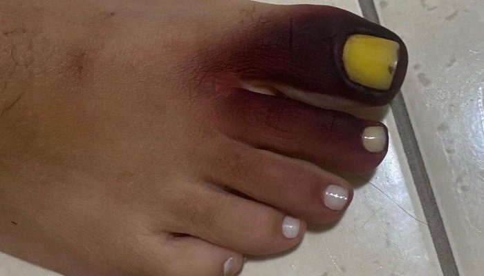 700x0_1635943334_1547097560