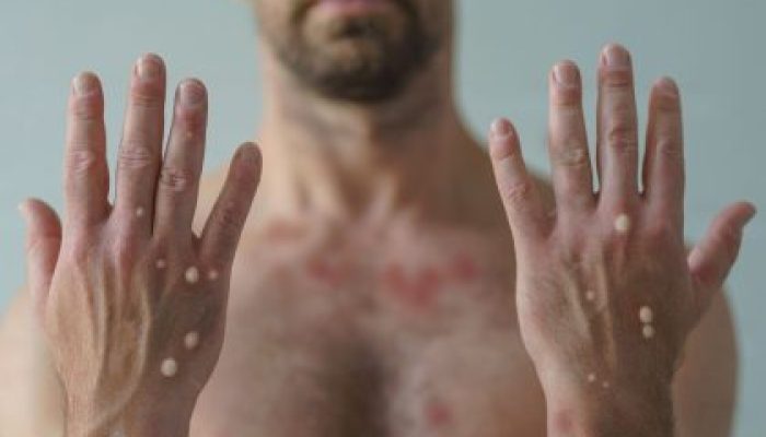 Imagem: Divulgação