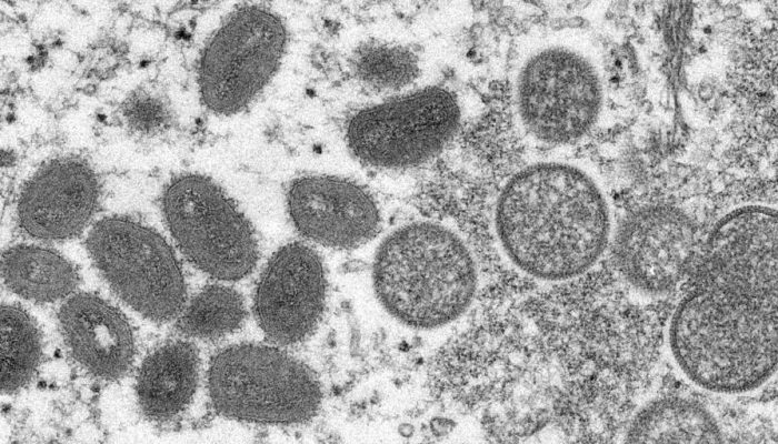 Foto: Cynthia S. Goldsmith / Centers for Disease Control and Prevention / AFP / CP