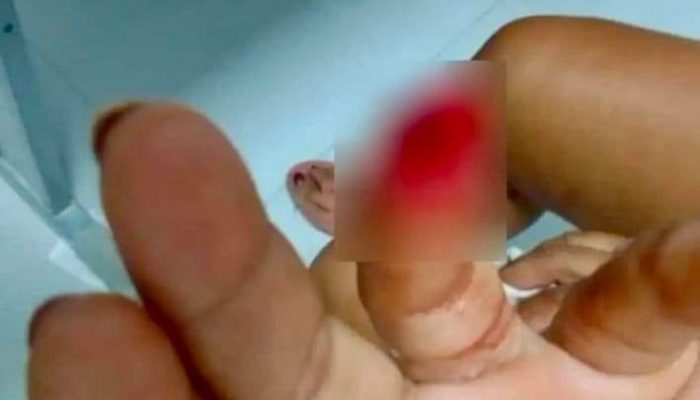 Foto: Divulgação BM