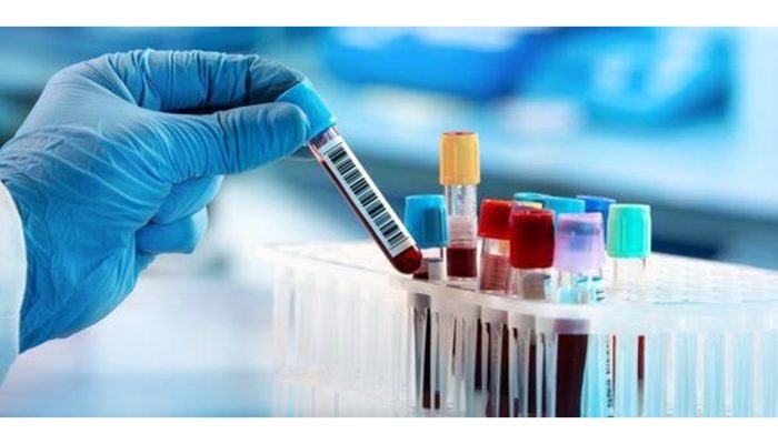 f32e2928c5fd7db989e710ee5624cdfa