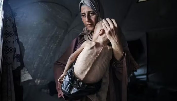 Foto: Ahmed Jihad Ibrahim Al-arini/Anadolu via Getty Images