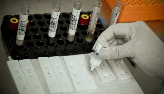 Foto: Breno Esaki/Saúde-DF