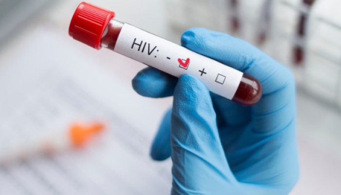 hiv