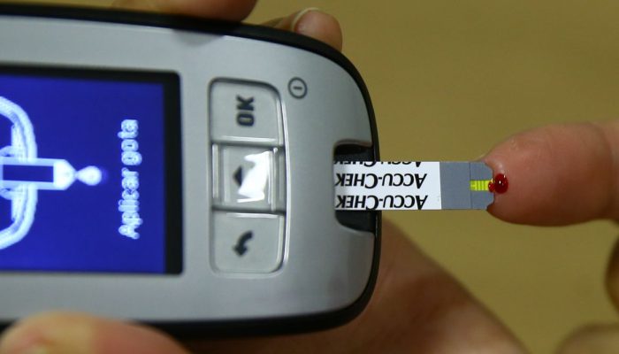 Exame da curva glicêmica; insulina,monitor de glicemia