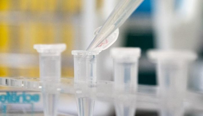 Foto: Joe Klamar / AFP / CP