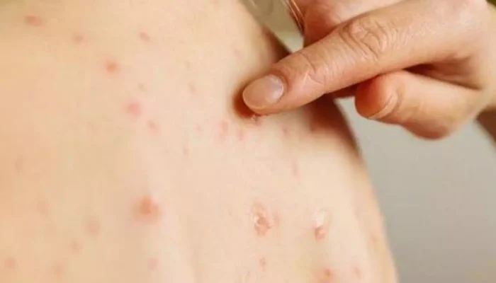 Foto: Agência Brasil