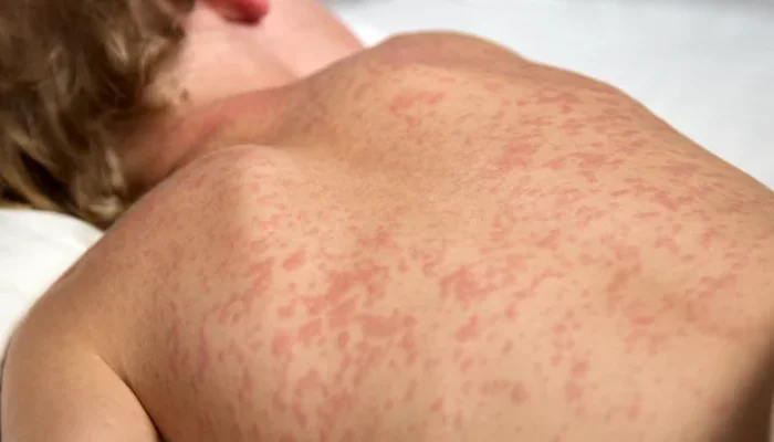 Foto: Reprodução/MS